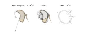פתרונות לקיבוע מרוול לאתר